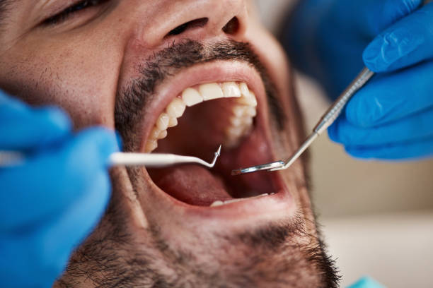 Professional Emergency Dentist in LA