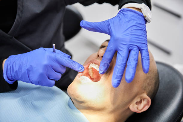 Best Emergency Broken Tooth Repair in Mansura, LA